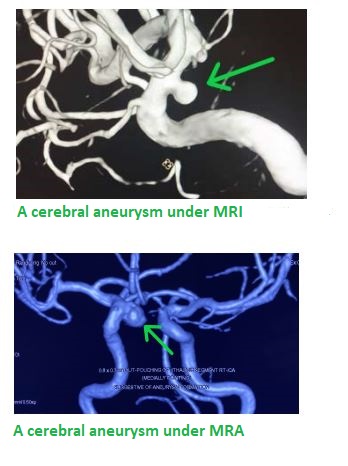 MRI_and_MRA+HKBSSP - en