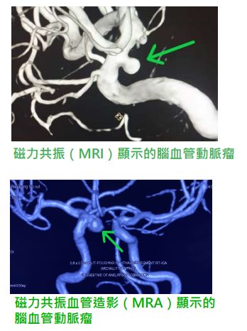 MRI_and_MRA-HKBSSP